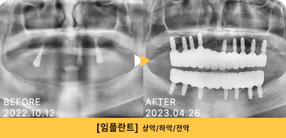 754e8750780a760137da560d1efcd615_1768541030_8114.jpg 754e8750780a760137da560d1efcd615_1768541030_8114.jpg